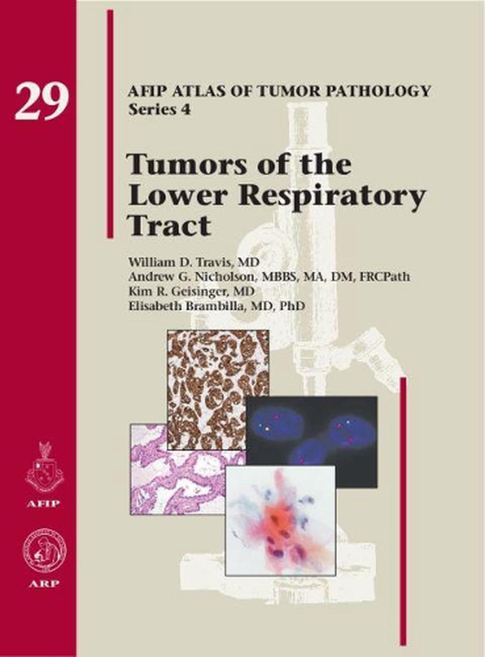 Tumors of the Lower Respiratory Tract, 9781933477466