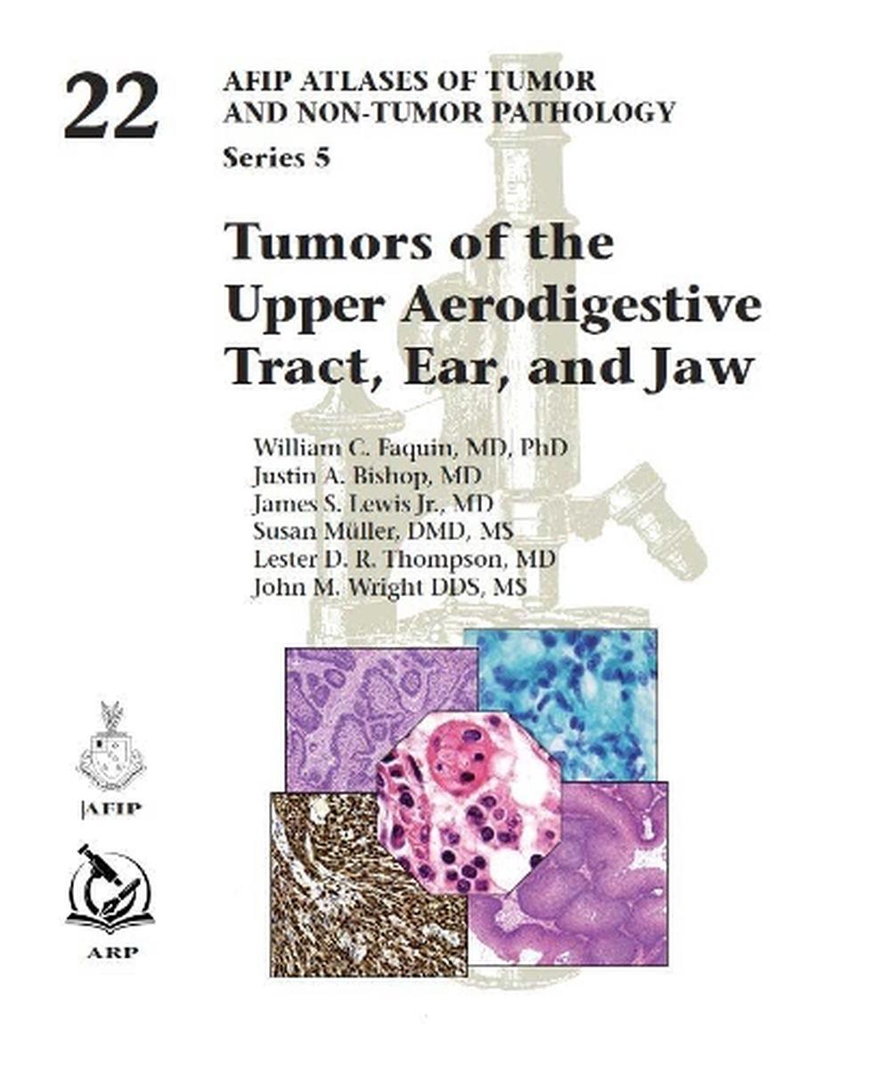 Tumors of the Upper Aerodigestive Tract, Ear, and Jaw, 9781933477619