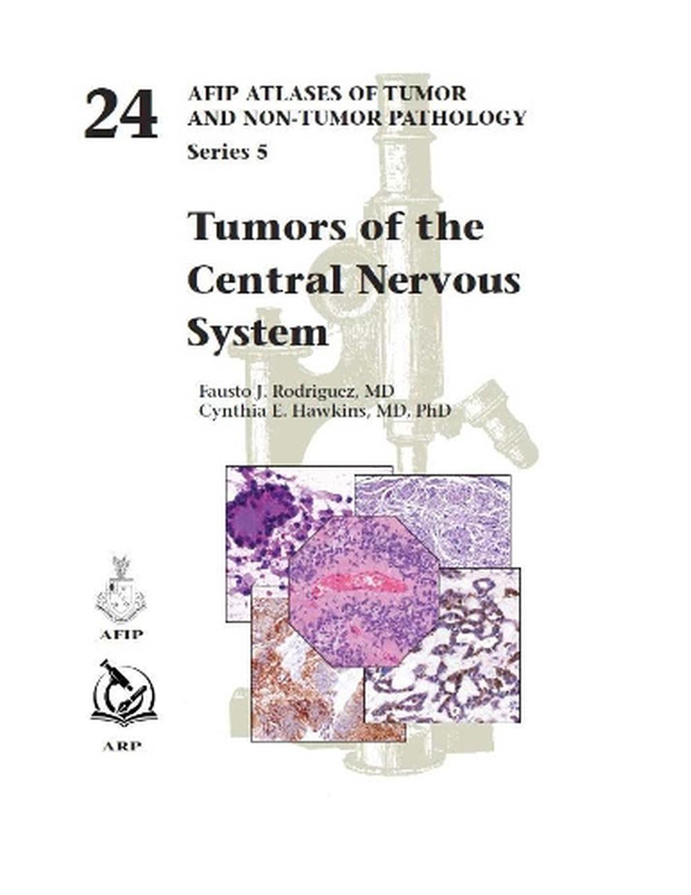 Tumors of the Central Nervous System, 9781933477640
