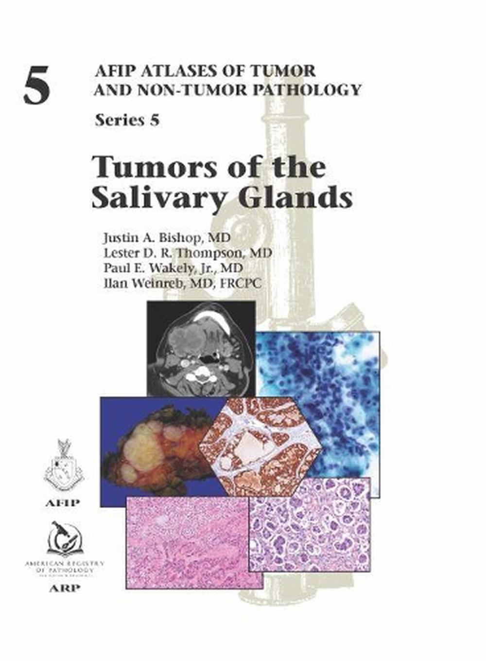 Tumors of the Salivary Glands, 9781933477947