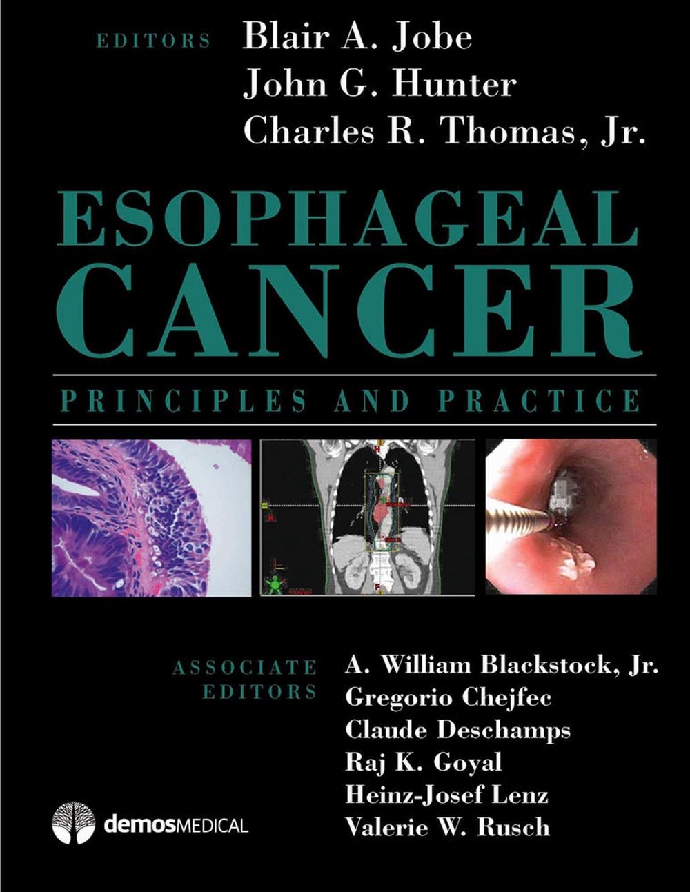 Esophageal Cancer: Principles and Practice, 9781933864174
