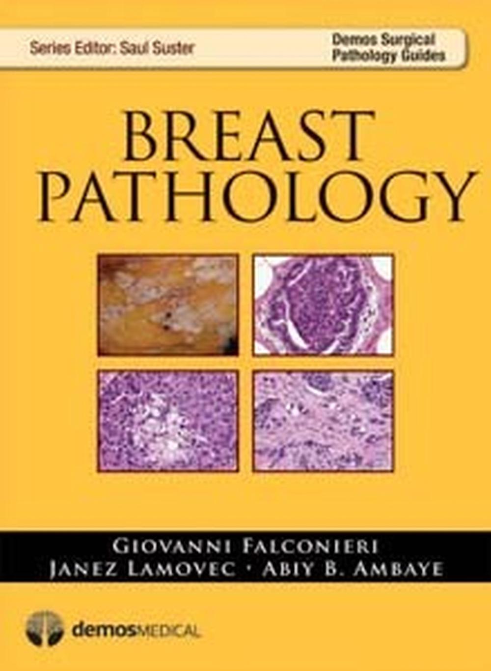 Breast Pathology, 9781936287307