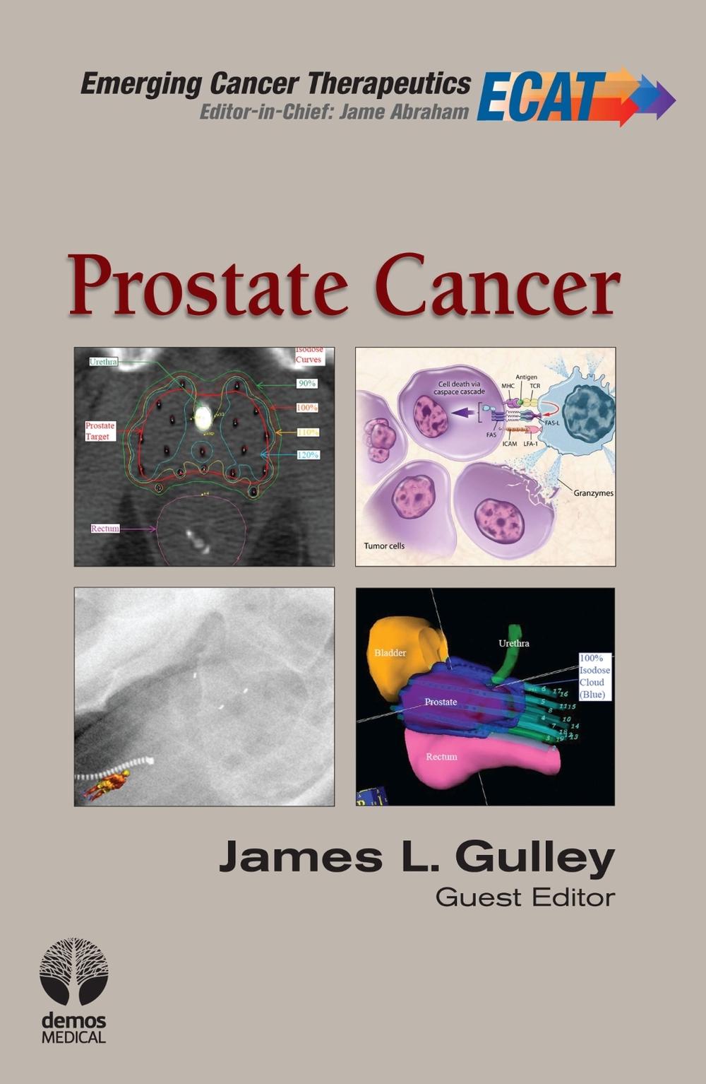 Prostate Cancer, 9781936287468