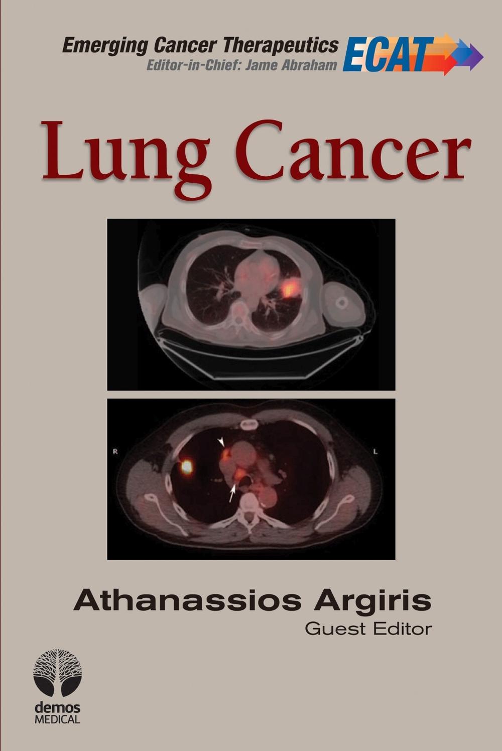 Lung Cancer, 9781936287529