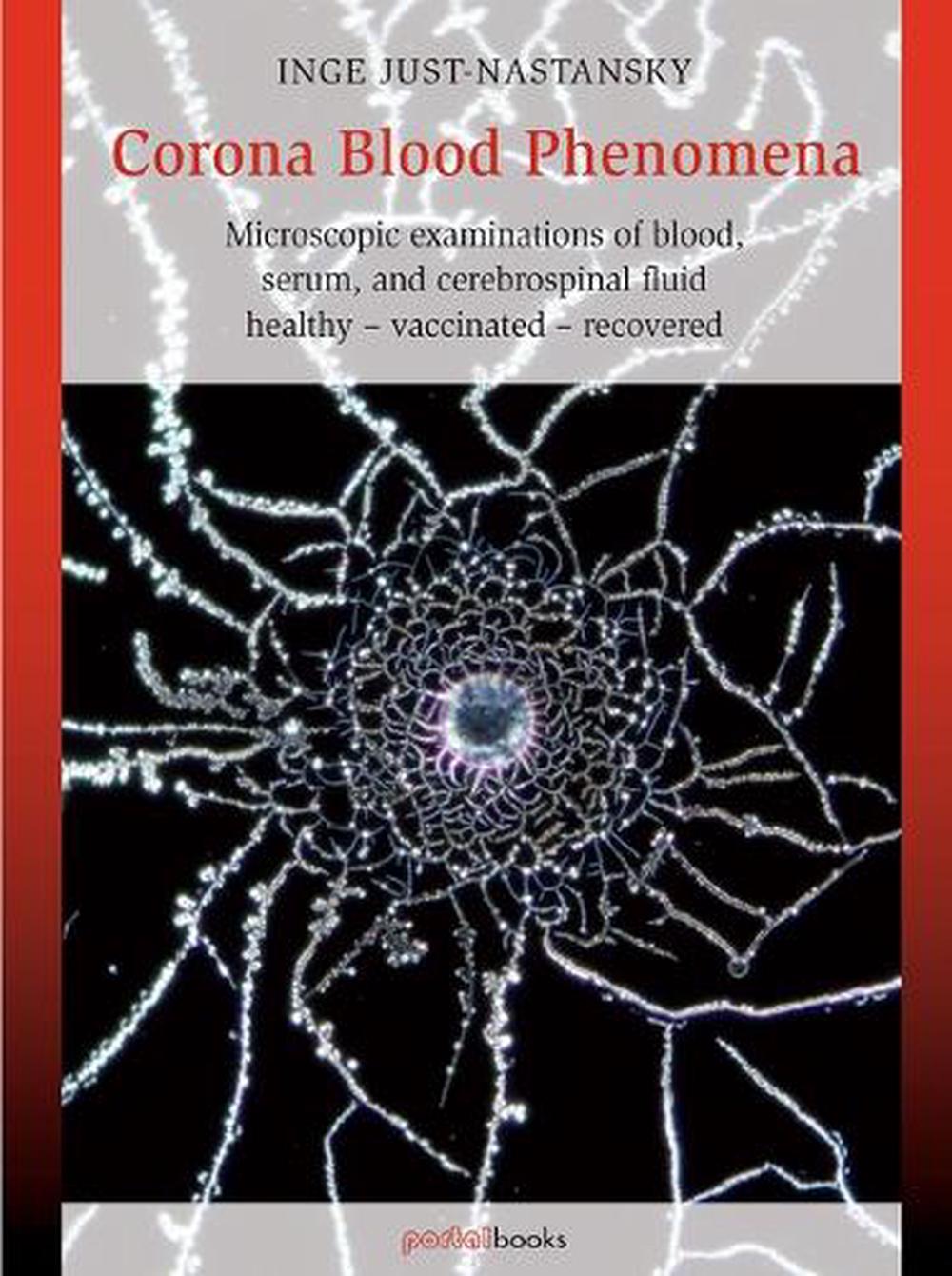 Corona Blood Phenomena, 9781938685453
