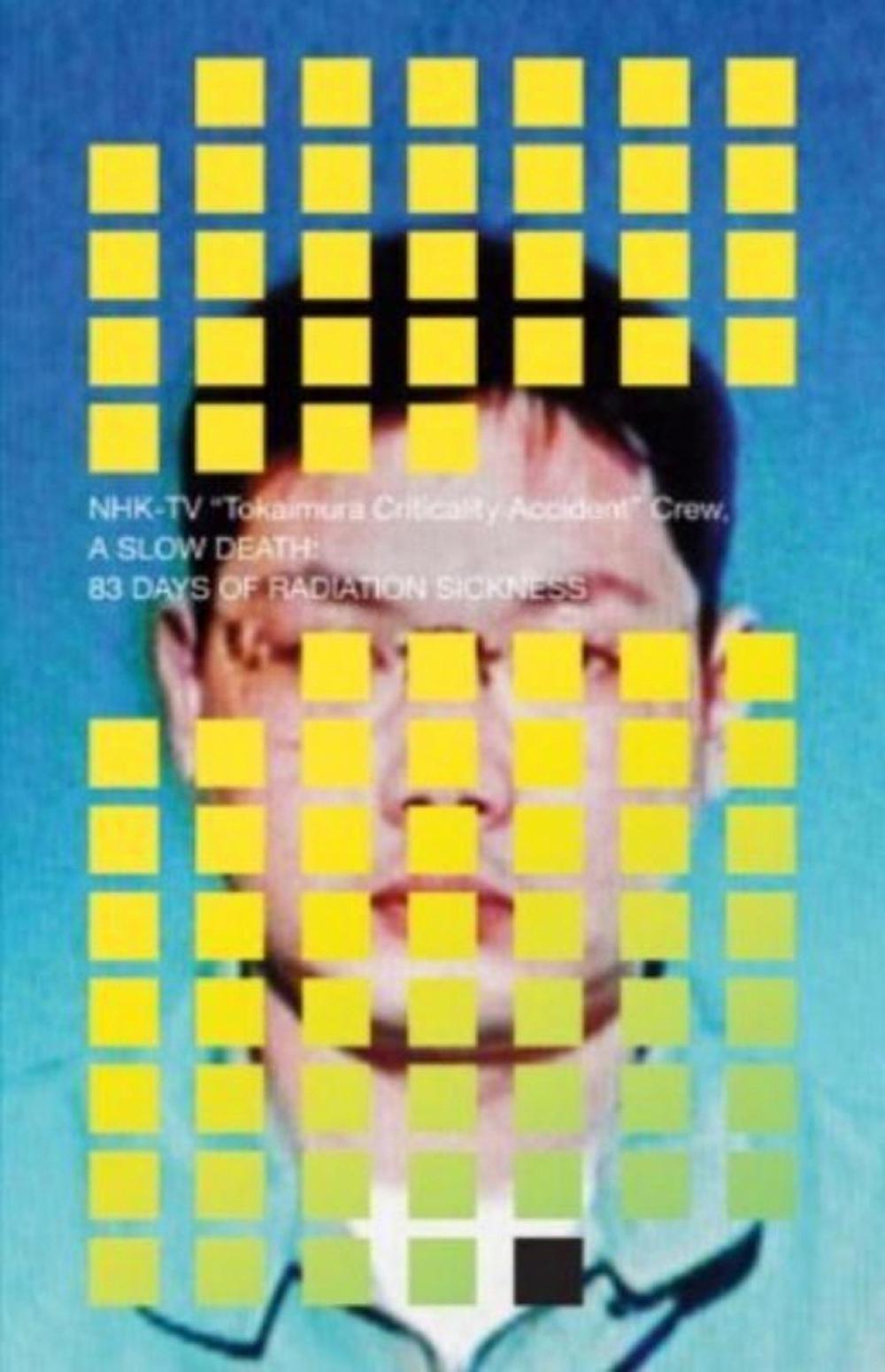 A Slow Death: 83 Days of Radiation Sickness, 9781942993544