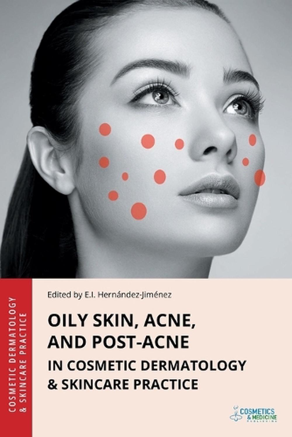 Oily Skin, Acne, and Post-Acne in Cosmetic Dermatology & Skincare Practice, 9781970196252