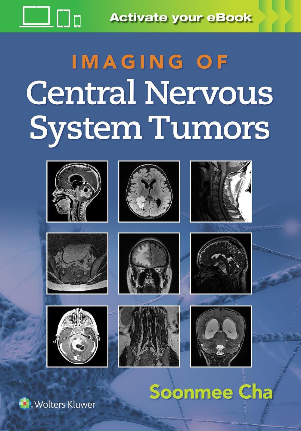 Imaging of Central Nervous System Tumors, 9781975103743