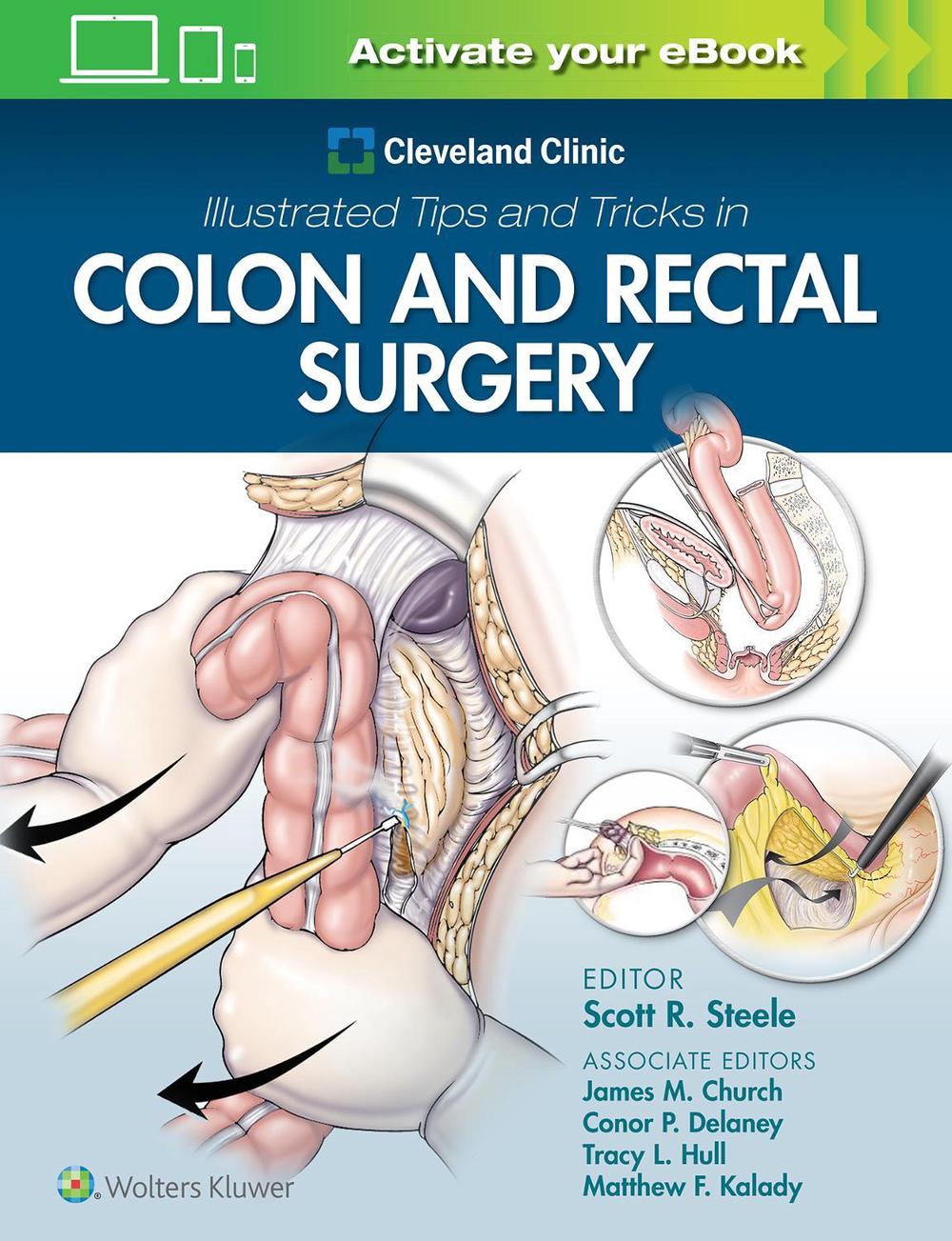 Cleveland Clinic Illustrated Tips and Tricks in Colon and Rectal Surgery, 9781975108250