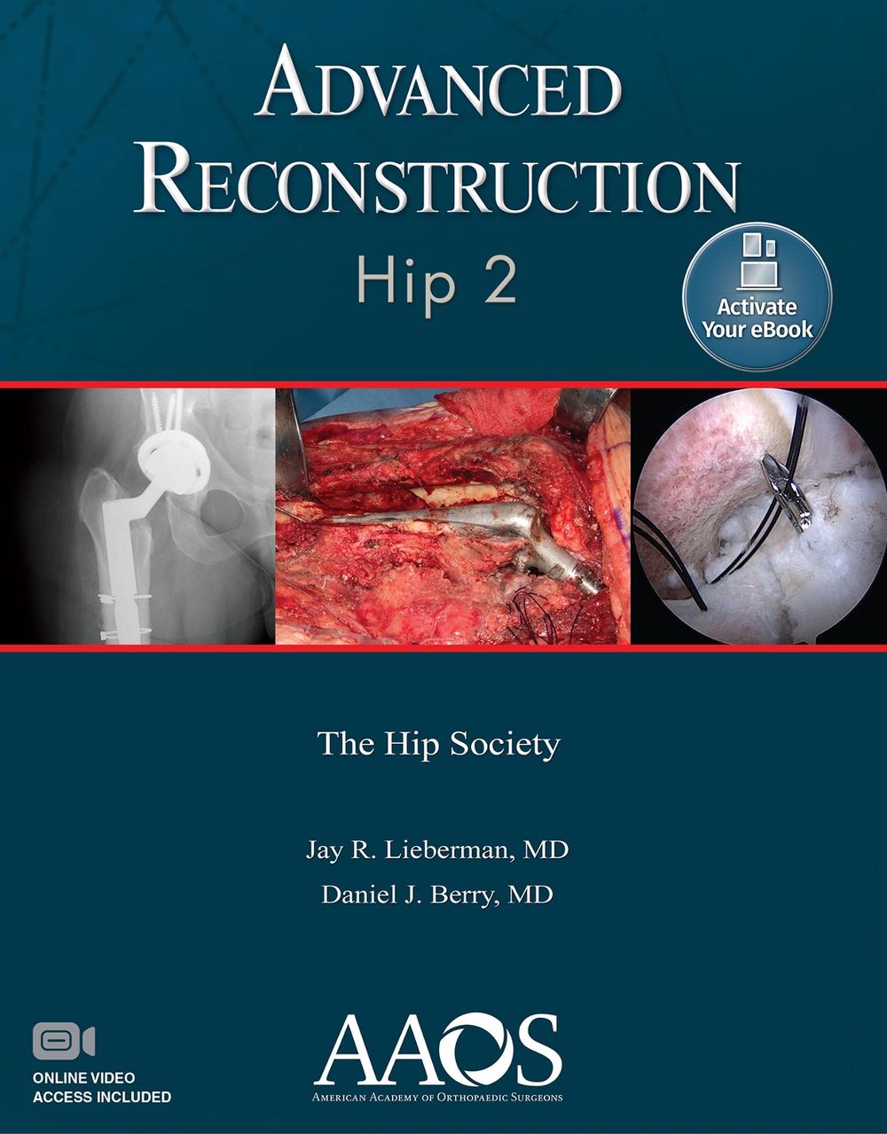 Advanced Reconstruction: Hip 2: Print + Ebook with Multimedia, 9781975123833