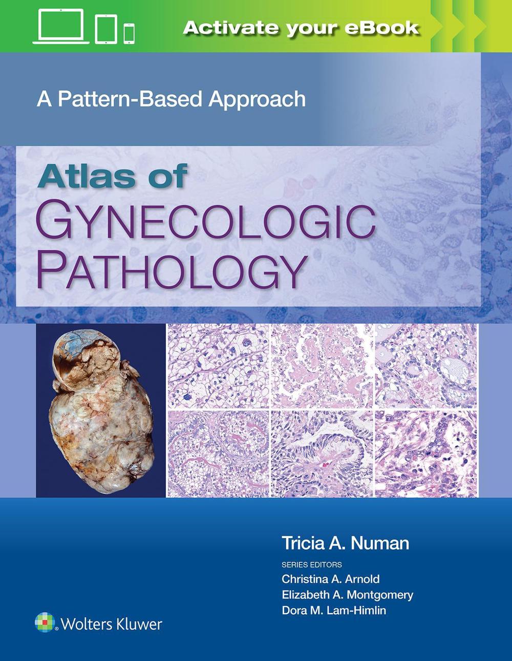 Atlas of Gynecologic Pathology by Tricia A. Numan - ISBN: 9781975124762