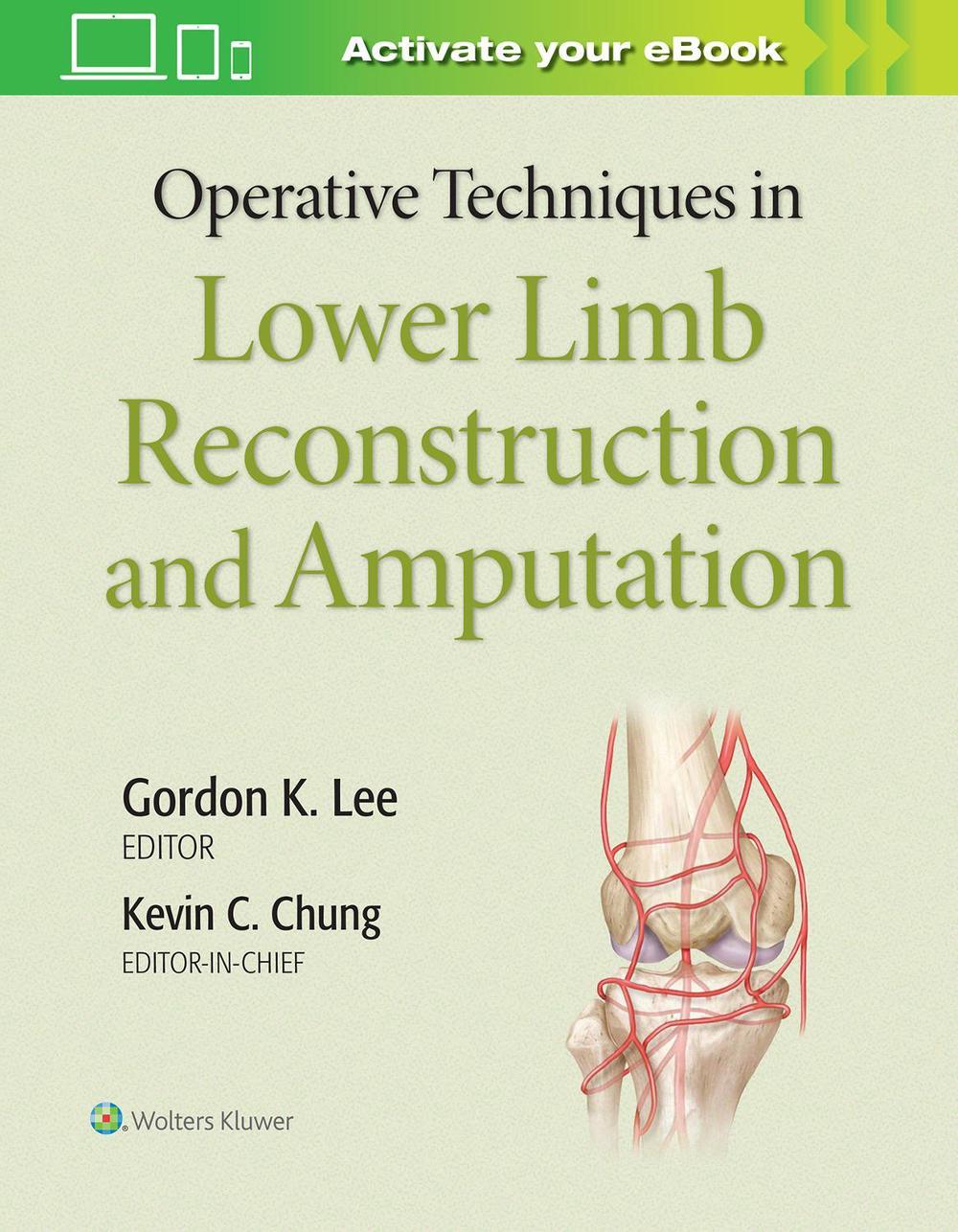 Operative Techniques in Lower Limb  Reconstruction and Amputation, 9781975127343