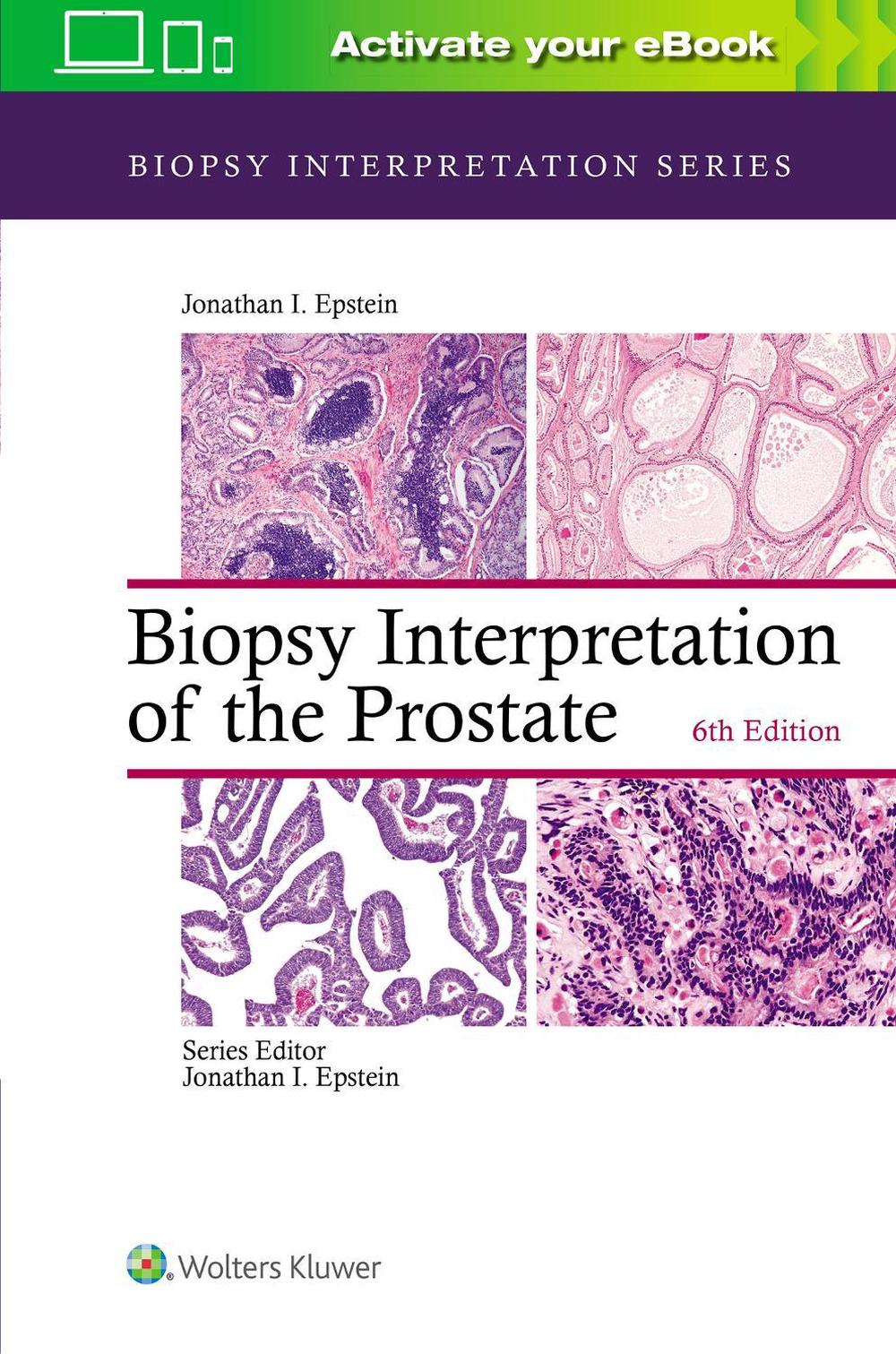 Biopsy Interpretation of the Prostate, 6th Edition, 9781975136543