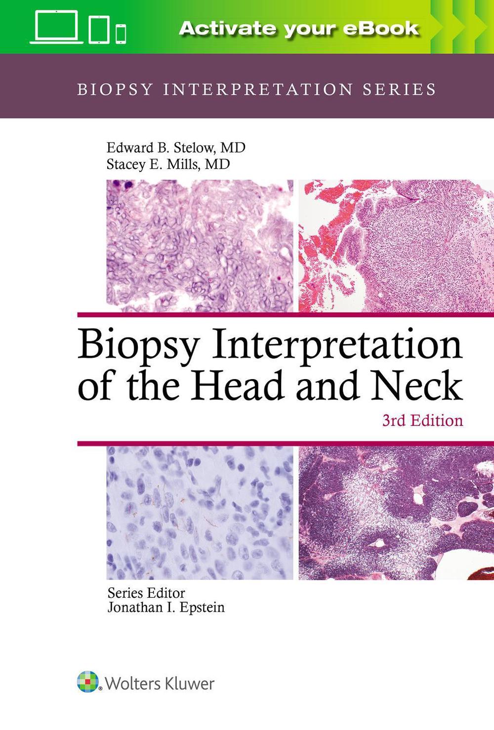 Biopsy Interpretation of the Head and Neck, 3rd Edition, 9781975139360