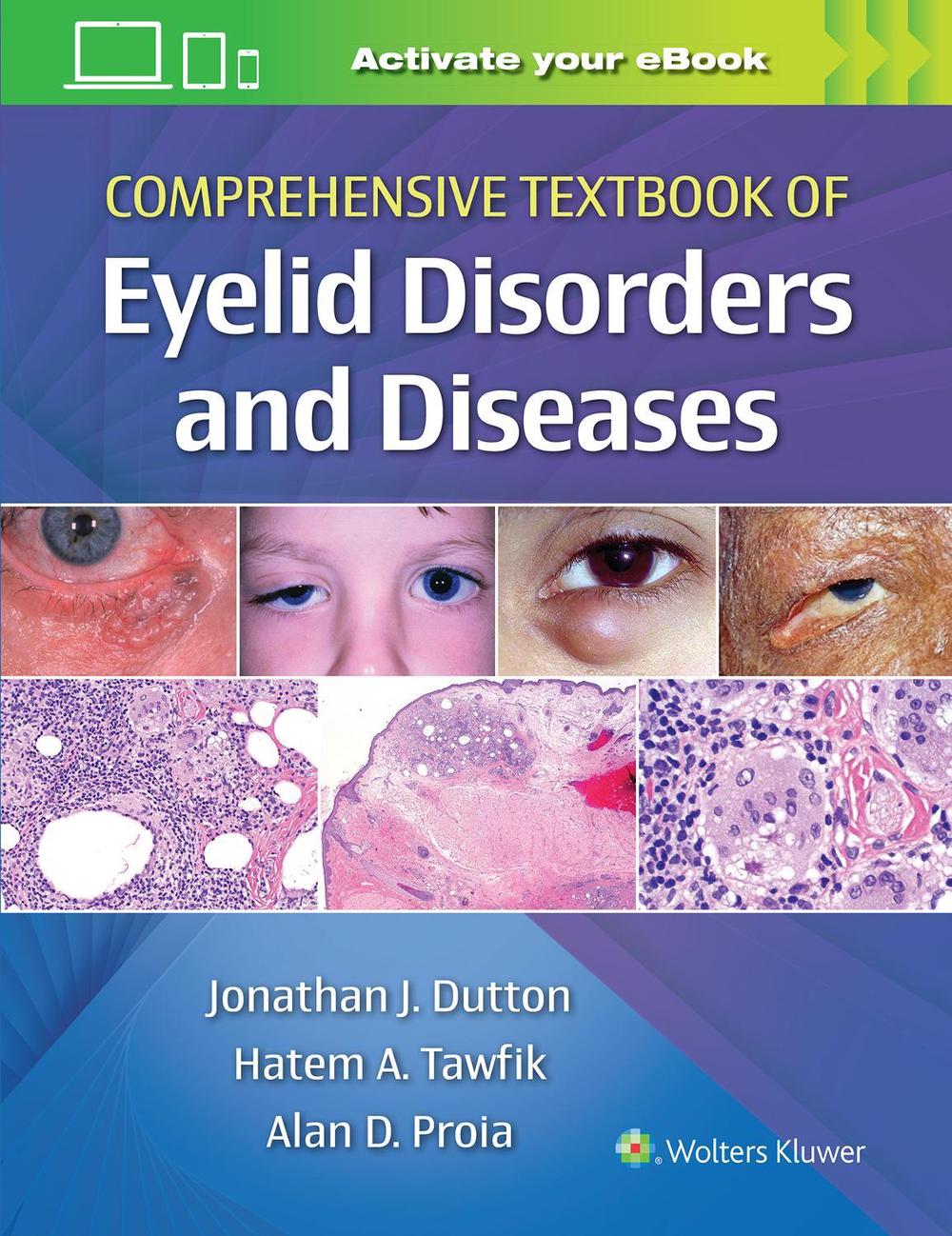 Comprehensive Textbook of Eyelid Disorders and Diseases, 9781975146146