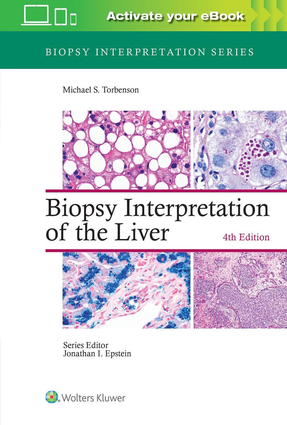 Biopsy Interpretation of the Liver, 9781975157296