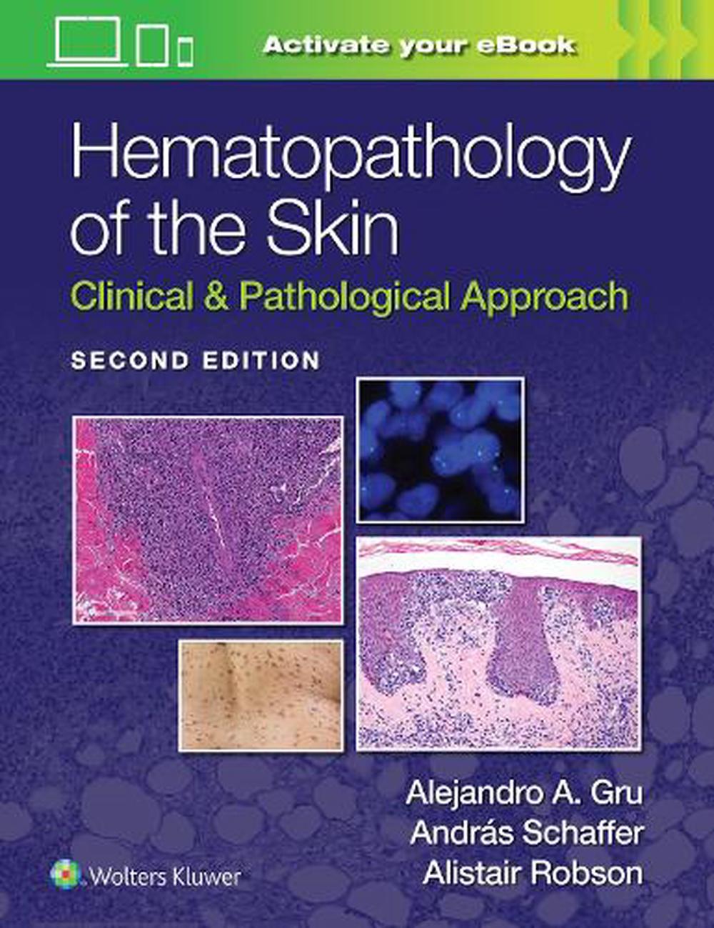 Hematopathology of the Skin by Alejandro Ariel Gru, Hardcover ...