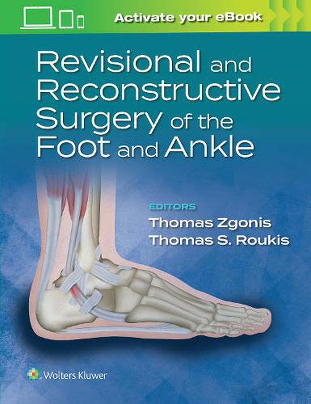 Revisional　The　the　Hardcover,　Foot　and　Zgonis,　at　online　Ankle　Buy　of　Reconstructive　9781975160821　Nile　by　and　Surgery　Thomas
