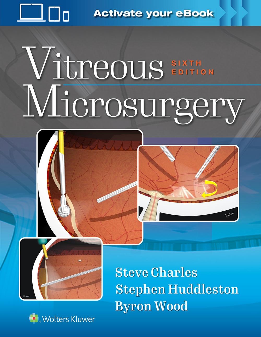 Vitreous Microsurgery, 9781975168353