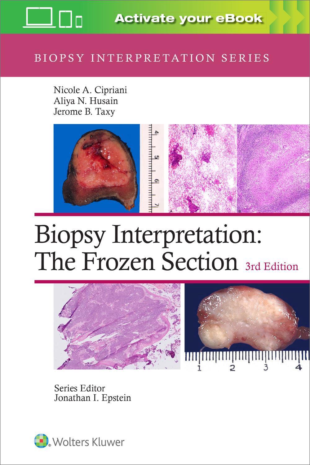 Biopsy Interpretation: The Frozen Section: Print + eBook with Multimedia, 3rd Edition, 9781975170073