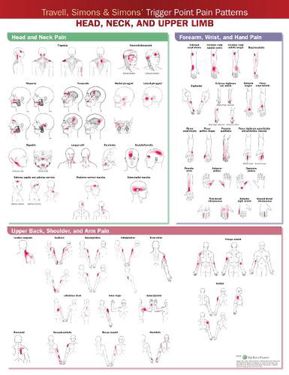 Travell, Simons & Simons Trigger Point Pain Patterns Wall Chart by ACC ...