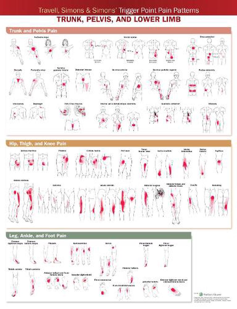 Travell, Simons & Simons Trigger Point Pain Patterns Wall Chart by