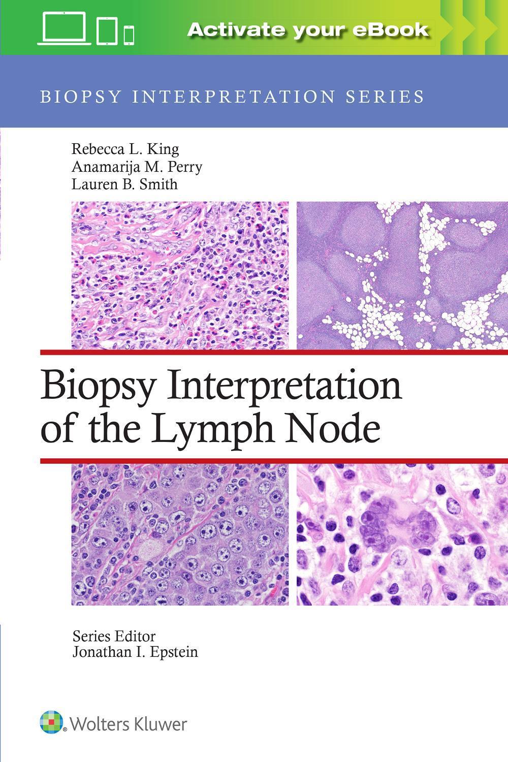 Biopsy Interpretation of the Lymph Node: Print + eBook with Multimedia, 9781975184629