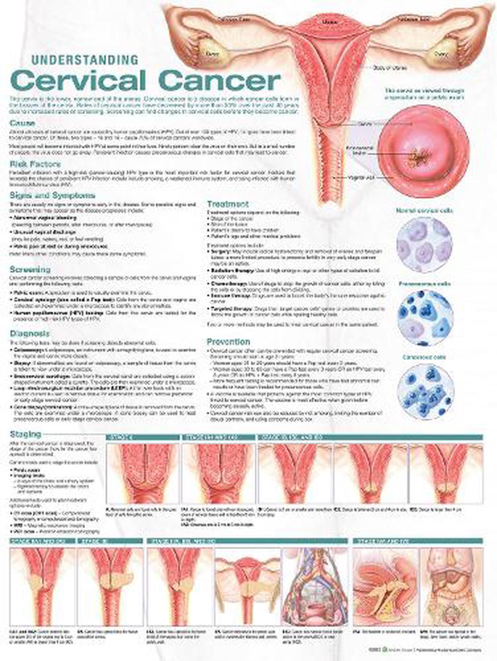 short speech on cervical cancer