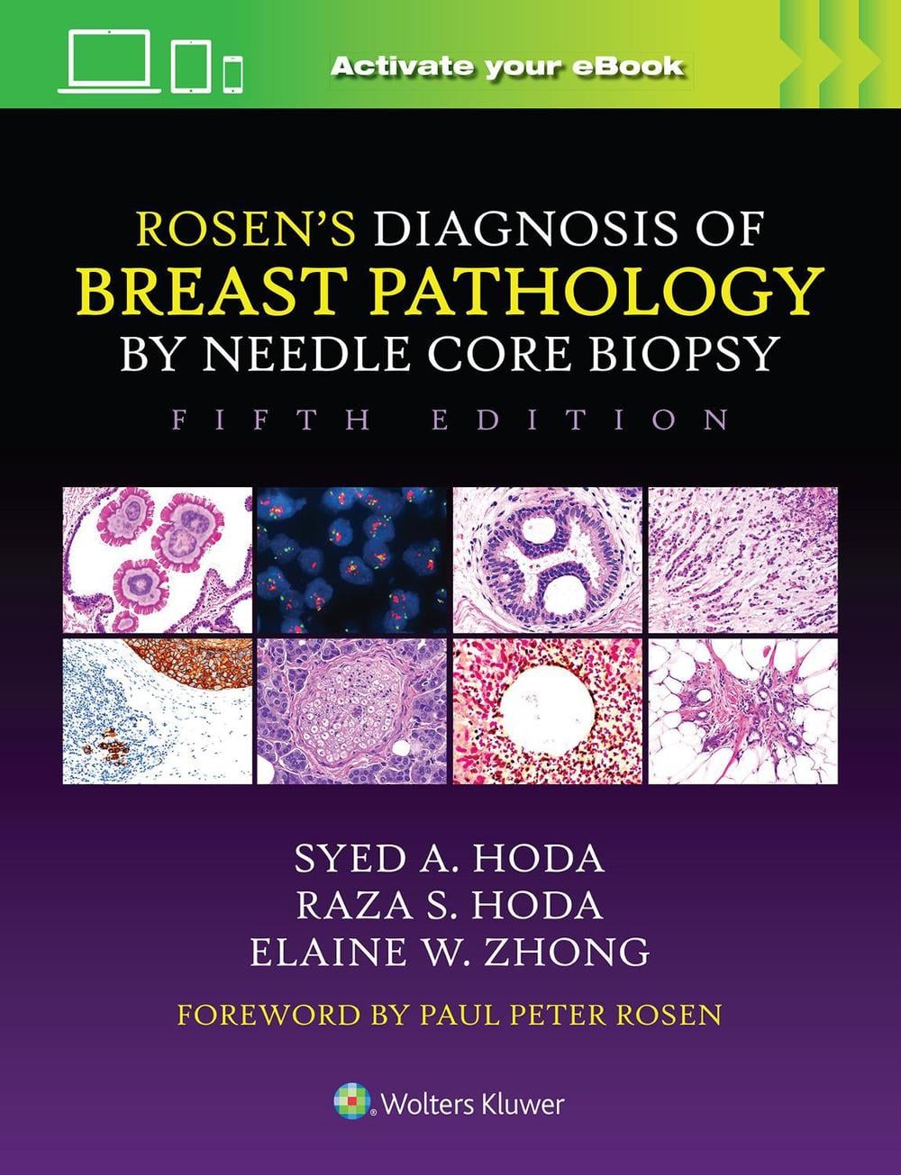 Rosen's Diagnosis of Breast Pathology by Needle Core Biopsy, 5th Edition by Syed A. Hoda - ISBN: 9781975198367