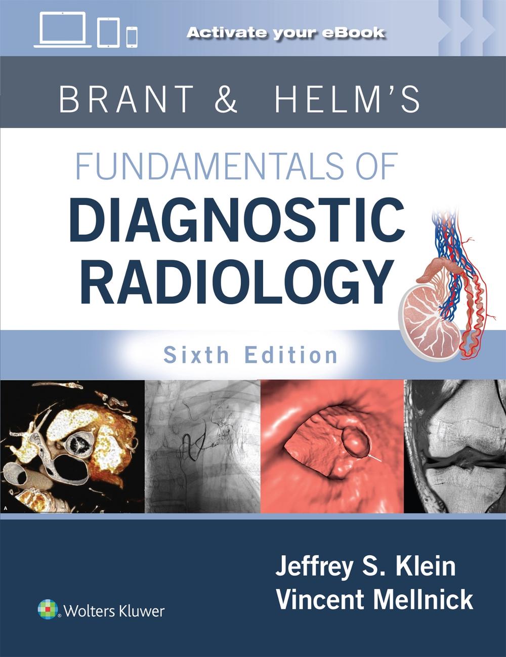 Brant & Helms' Fundamentals of Diagnostic Radiology: Print + eBook with Multimedia, 9781975199005
