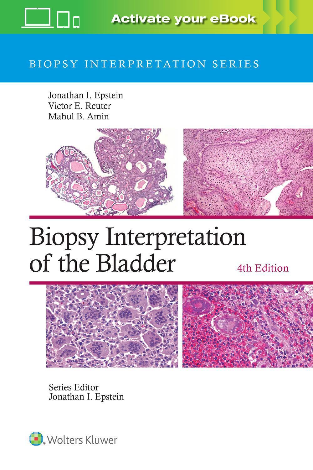 Biopsy Interpretation of the Bladder: Print + eBook with Multimedia, 4th Edition, 9781975199203