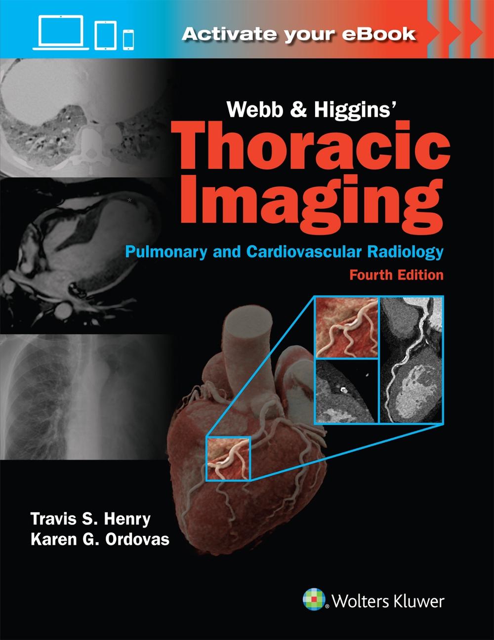 Webb & Higgins Thoracic Imaging: Print + eBook with Multimedia, 9781975199388
