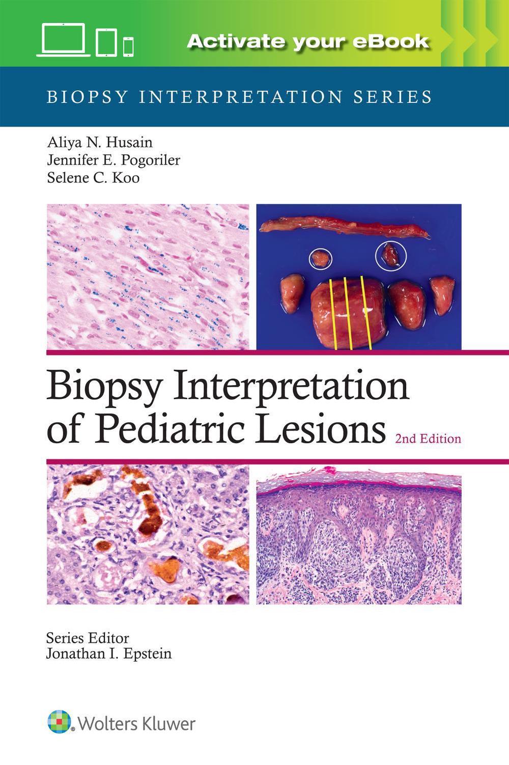 Biopsy Interpretation of Pediatric Lesions: Print + eBook with Multimedia, 9781975213268
