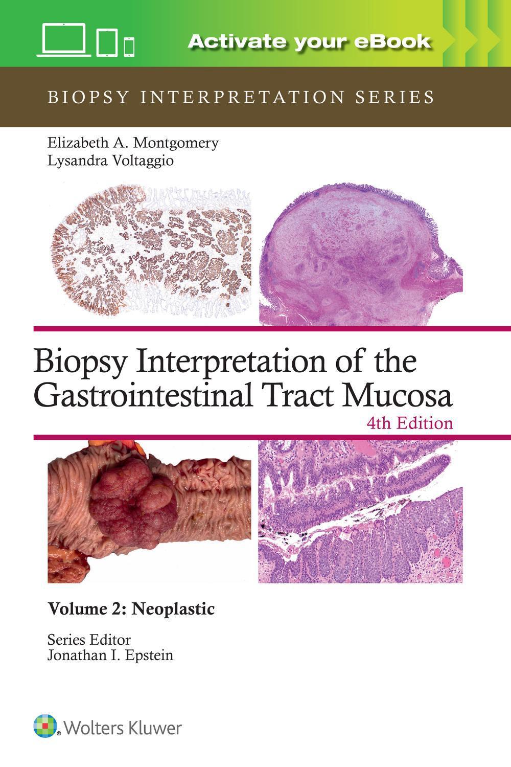 Biopsy Interpretation of the Gastrointestinal Tract Mucosa Volume 2, 9781975213695
