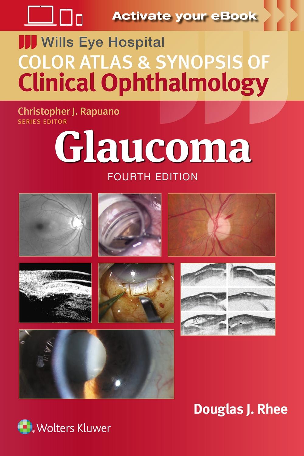 Glaucoma, 9781975214814
