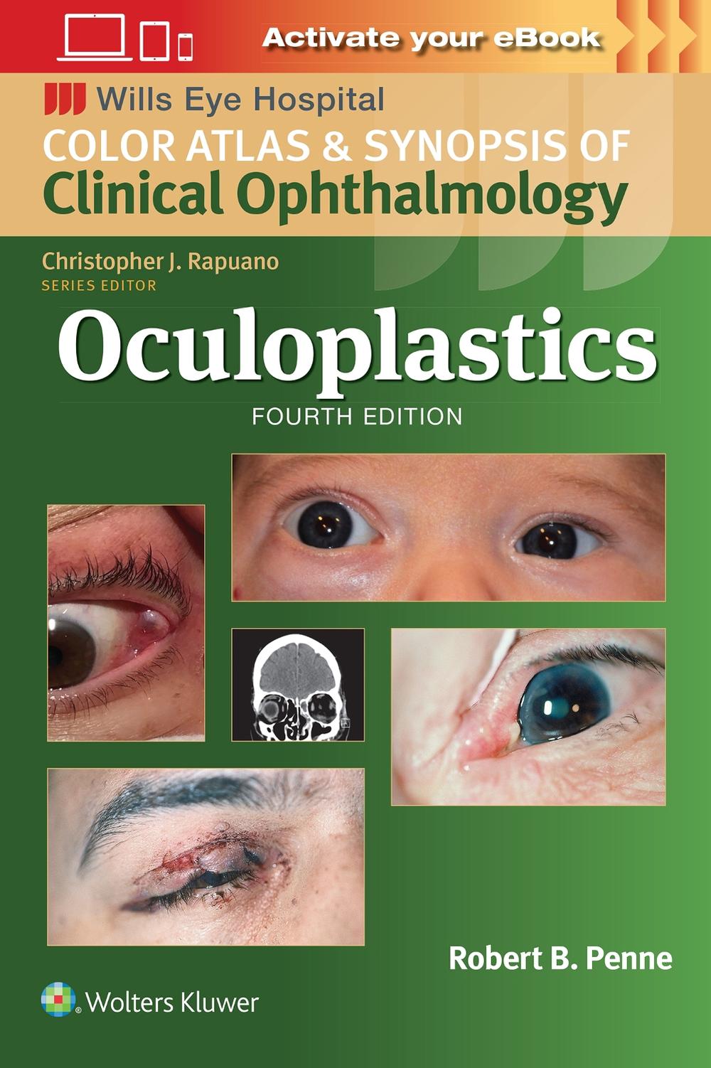 Oculoplastics, 9781975214876