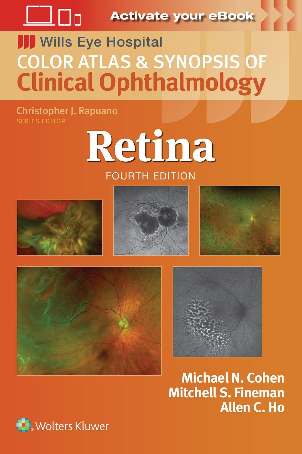 Retina, 9781975215149