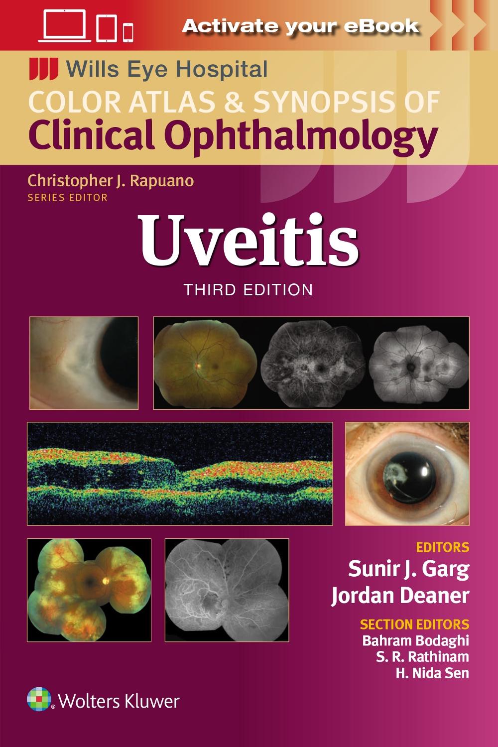 Uveitis, 9781975215194