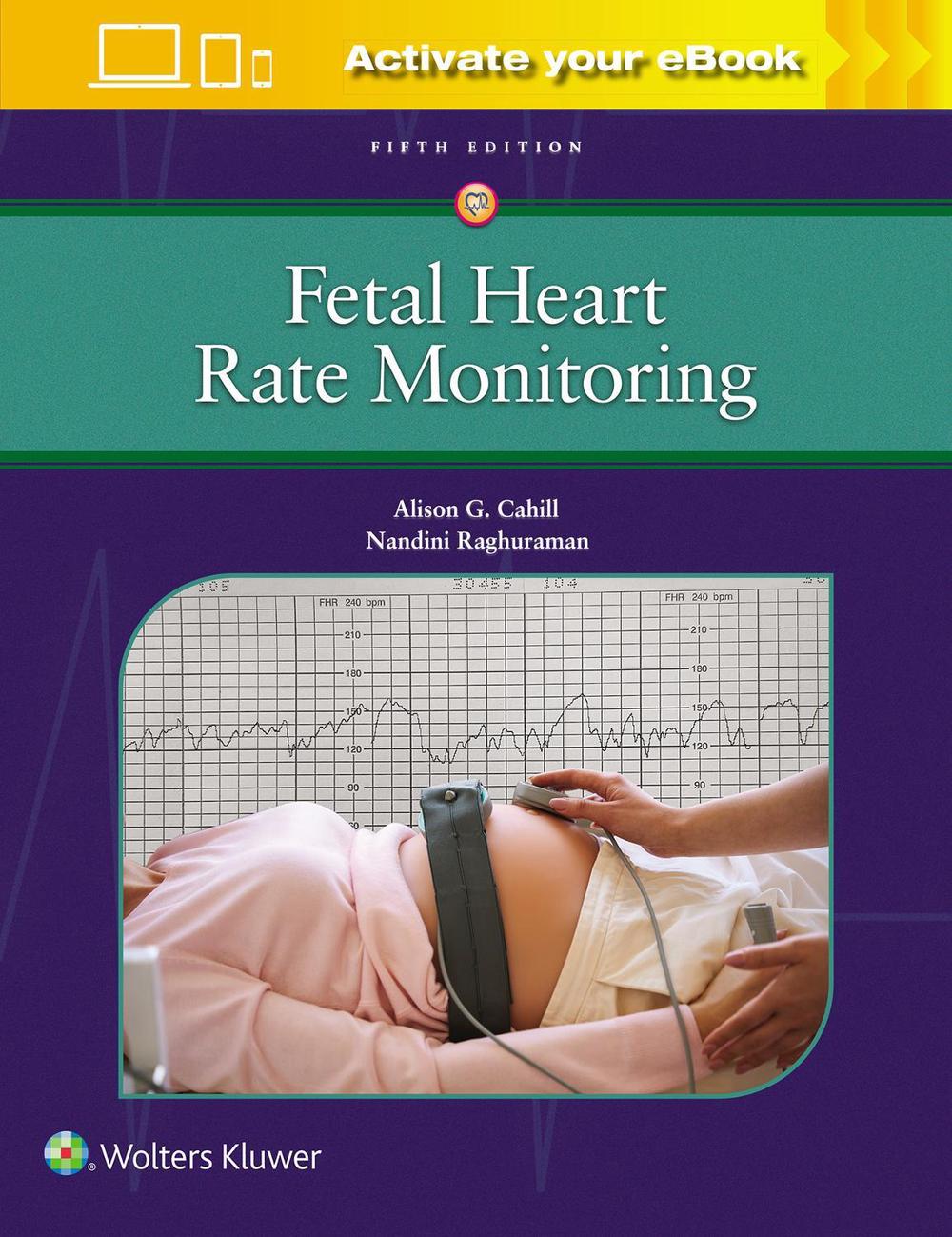 Fetal Heart Rate Monitoring, 9781975216184