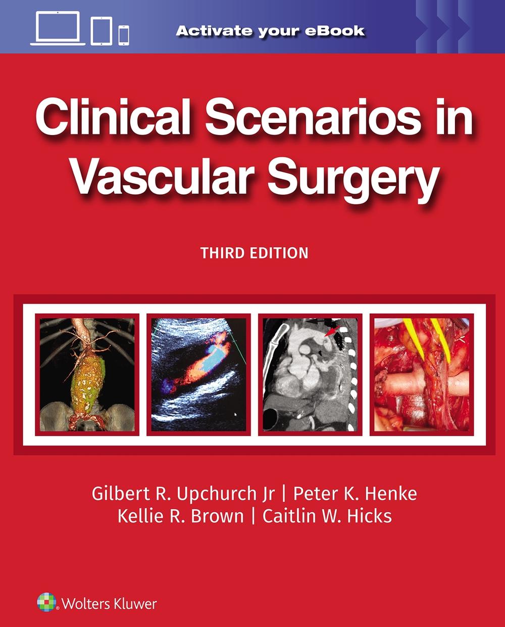 Clinical Scenarios in Vascular Surgery, 9781975216238