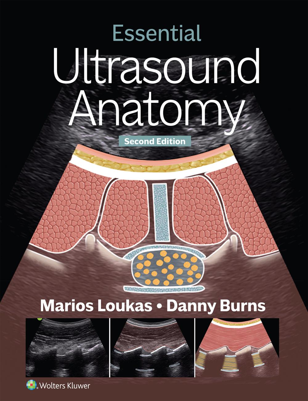 Essential Ultrasound Anatomy, 9781975216887
