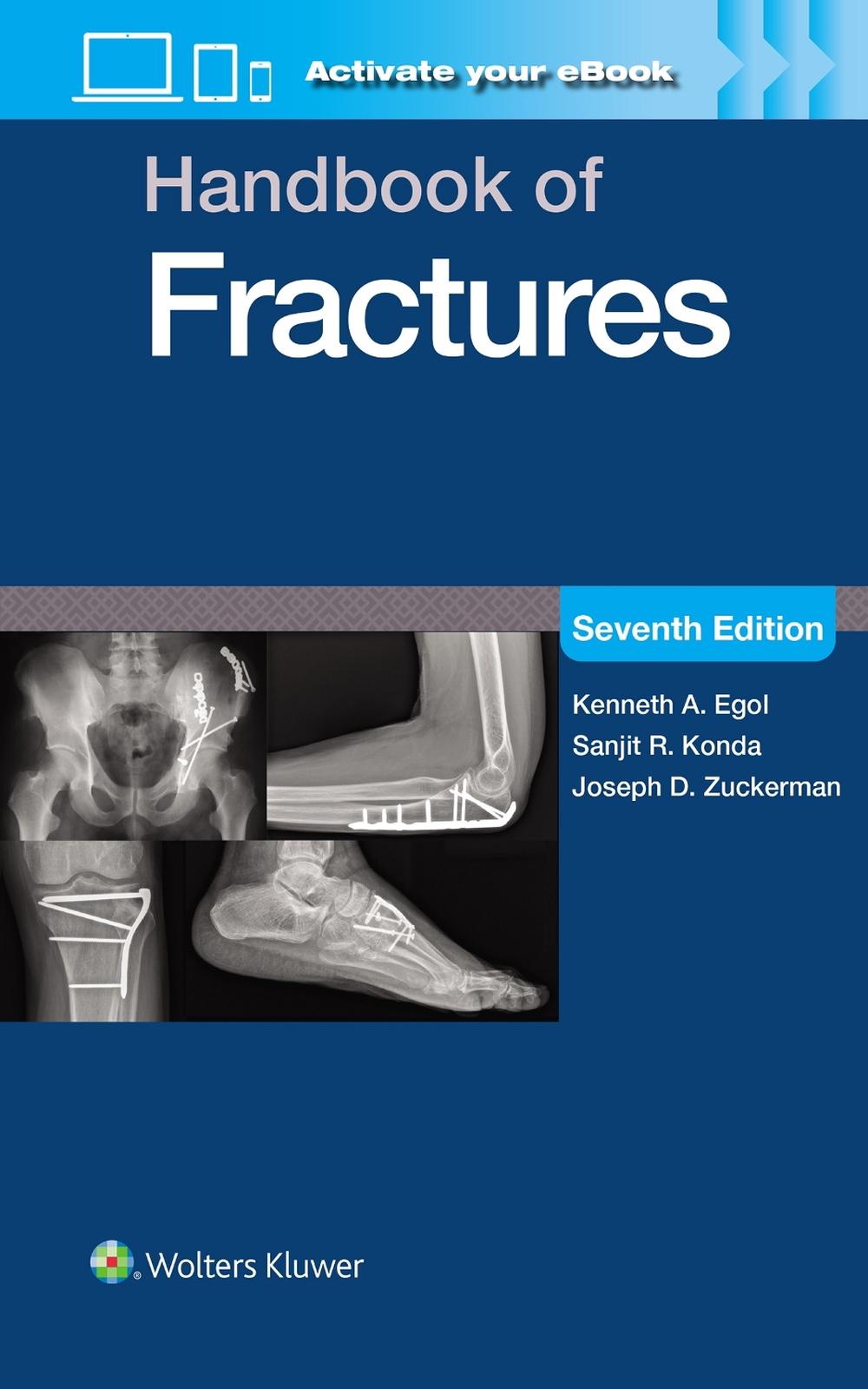 Handbook of Fractures: Print + eBook with Multimedia, 9781975217990