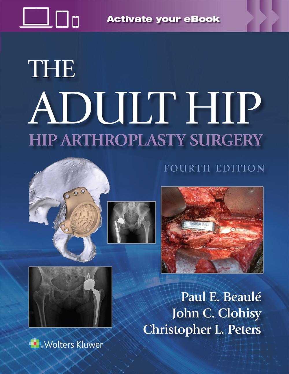 The Adult Hip: Hip Arthroplasty Surgery Print + eBook with Multimedia, 4th Edition by PAUL E. BEAULE - ISBN: 9781975221935