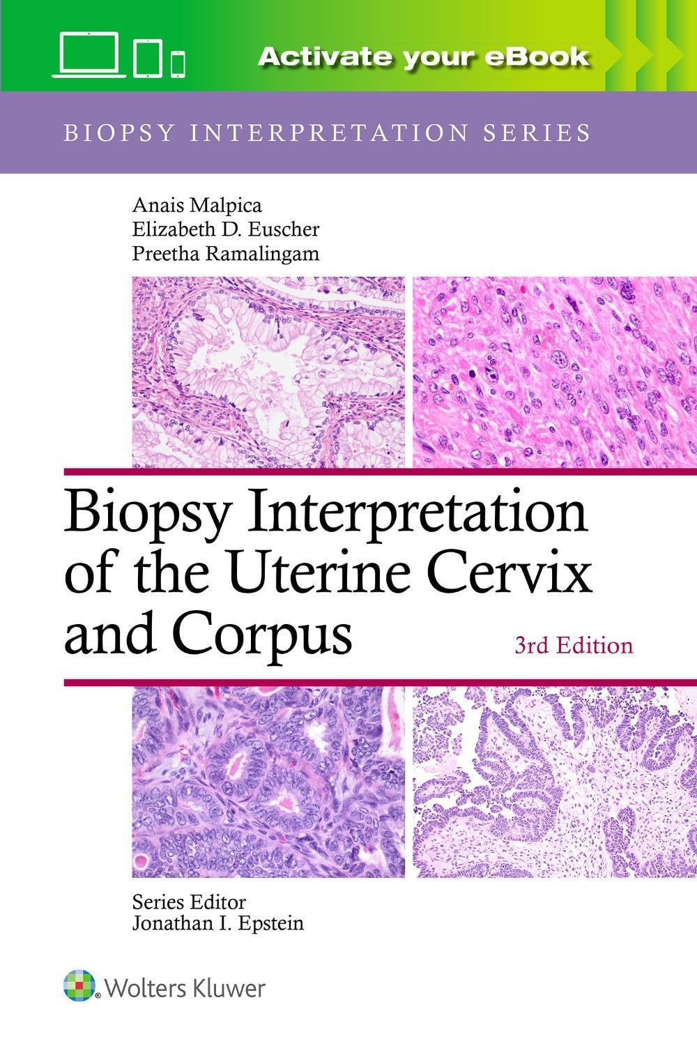 Biopsy Interpretation of the Uterine Cervix and Corpus: Print + eBook with Multimedia, 3rd Edition by ANAIS MALPICA - ISBN: 9781975236786