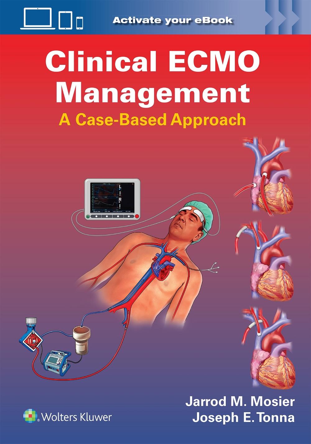 Clinical ECMO Management by Jarrod Mosier - ISBN: 9781975240141