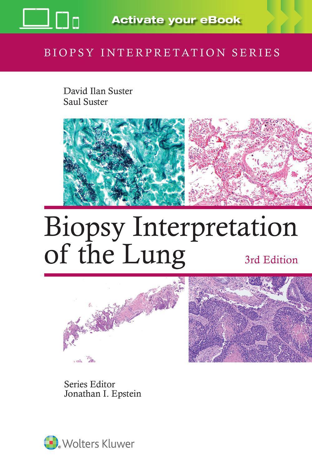 Biopsy Interpretation of the Lung, 3rd Edition, 9781975240677