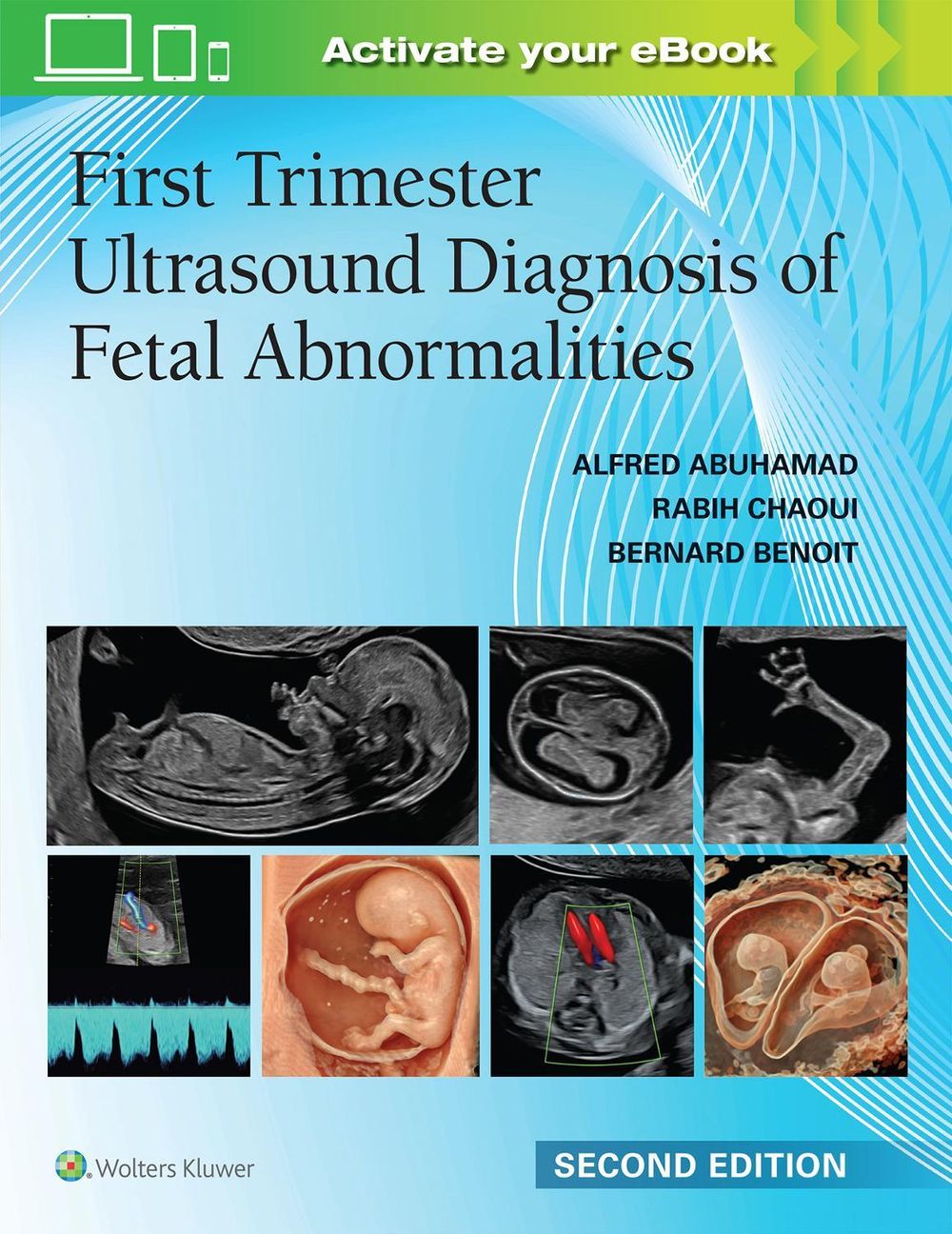 First Trimester Ultrasound Diagnosis of Fetal Abnormalities, 2nd Edition by ALFRED Z. ABUHAMAD - ISBN: 9781975242831