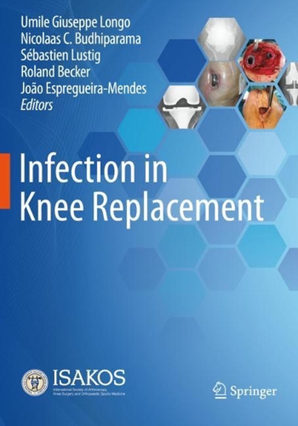 Infection In Knee Replacement By Umile Giuseppe Longo Paperback 9783030815554 Buy Online At