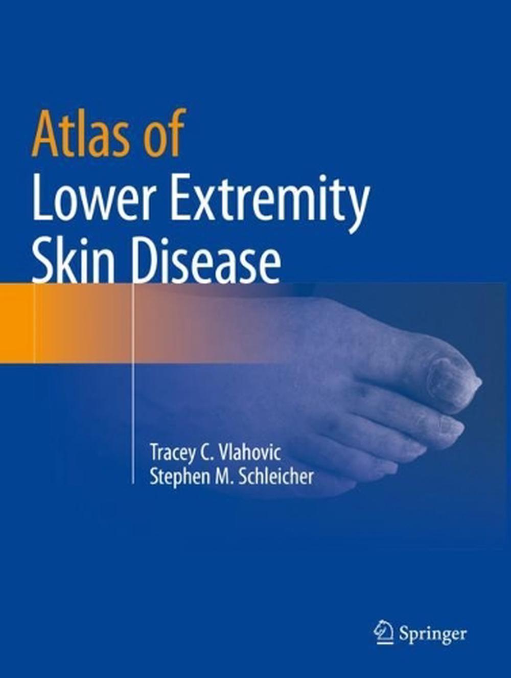 Atlas of Lower Extremity Skin Disease, 2022nd Edition, 9783031079528