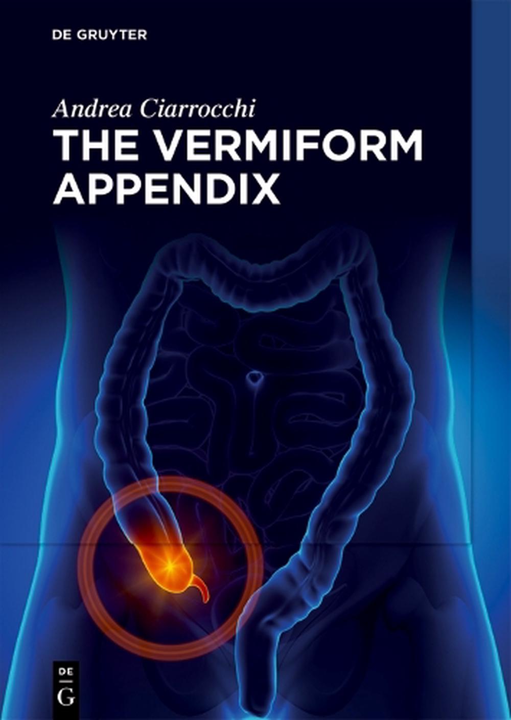 The Vermiform Appendix, 9783119143417